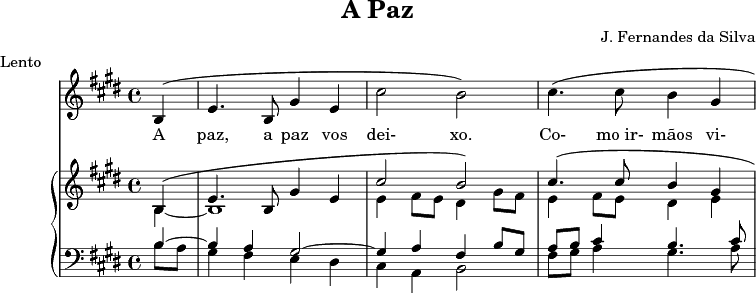 Extracto da música